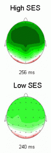 Children of high socioeconomic status (SES) show more activity (dark green) in the prefrontal cortex (top) than do kids of low SES when confronted with a novel or unexpected stimulus. (Mark Kishiyama/UC Berkeley)